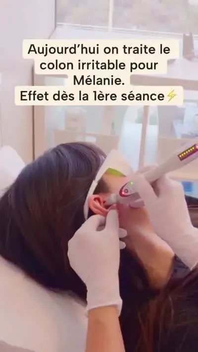 Séance de laser auriculaire pour un colon irritable, effet dès la première séance